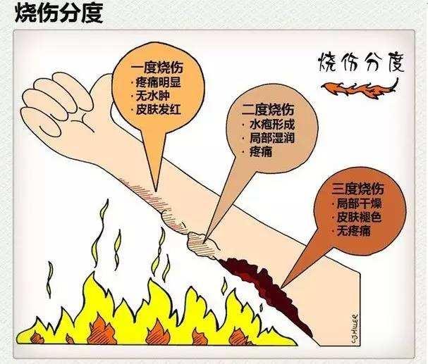 家庭应急伤口处理指南，为家人提供及时的急救措施