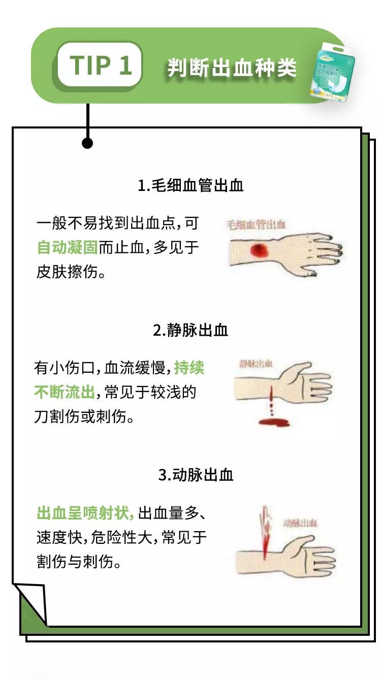 家庭成员严重外伤出血的应急处理指南